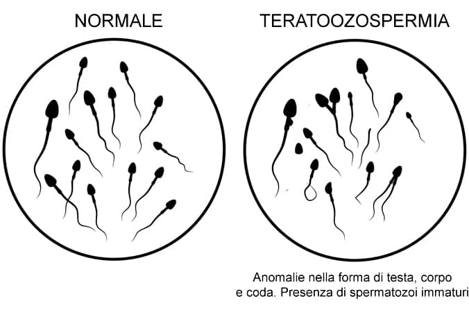 analisi sperma